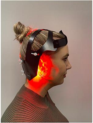 Protocol for randomized controlled trial to evaluate the safety and feasibility of a novel <mark class="highlighted">helmet</mark> to deliver transcranial light emitting diodes photobiomodulation therapy to patients with Parkinson’s disease